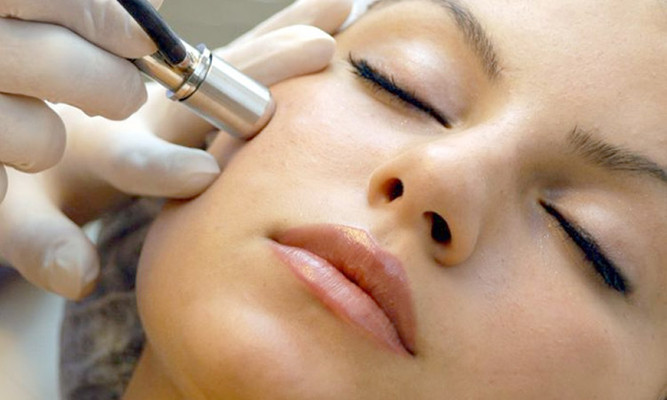 Алмазная микродермабразия косметология